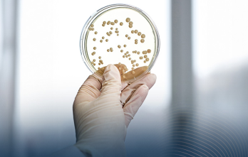 curso-sobre-identificacion-y-caracterizacion-molecular-de-patogenos